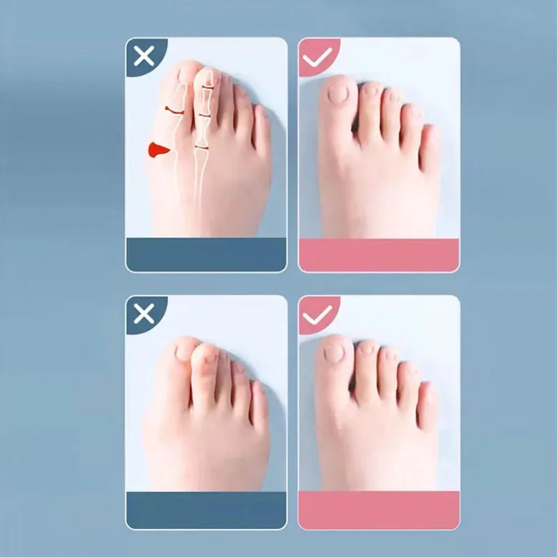 Silicone Toe Separators Gems for Bent Toes