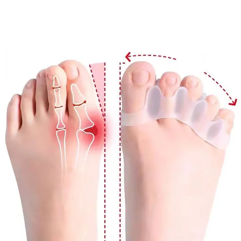 Silicone Toe Separators Gems for Bent Toes