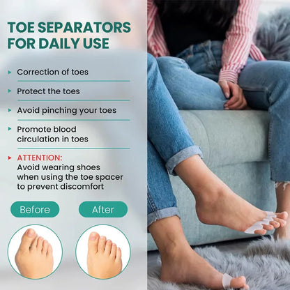 Silicone Toe Separators Gems for Bent Toes