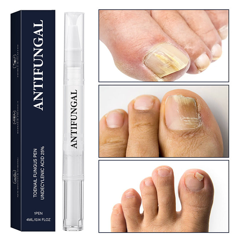 ✨New Arrivals🔥Toenail Fungus Treatment Pen for Damaged Nails