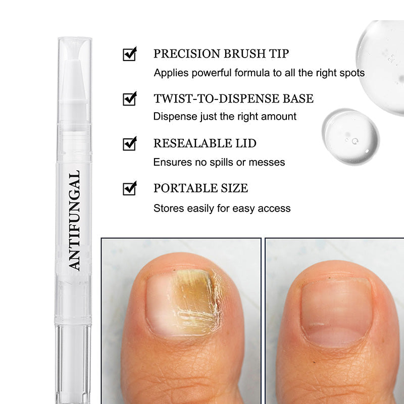 ✨New Arrivals🔥Toenail Fungus Treatment Pen for Damaged Nails